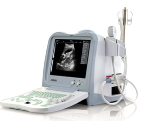 全數(shù)字b型超聲診斷儀kx5600