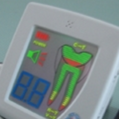 牙髓活力電測儀 yd-2