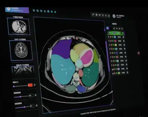醫(yī)學(xué)影像存檔與通信系統(tǒng)wisdom pacs v3.0