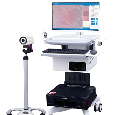 電子皮膚鏡錦源jy-2990