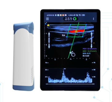 無線掌上彩色多普勒超聲診斷儀isoniq50供應(yīng)商