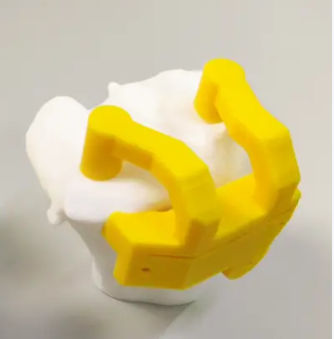 膝關(guān)節(jié)截骨個(gè)性化手術(shù)導(dǎo)板htopm-a廠家