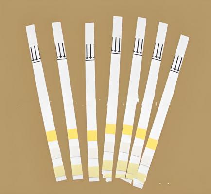 多項尿液分析試紙條（干化學(xué)法） 廠家